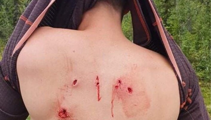 Daniel blev ordentligt biten innan björnhonan dog på hans rygg. Jaktkamraterna som hörde hans rop på hjälp på jaktradion sa att det lät som det sista dödsropet. Daniel blev ordentligt biten innan björnhonan dog på hans rygg. Jaktkamraterna som hörde hans rop på hjälp på jaktradion sa att det lät som det sista dödsropet.